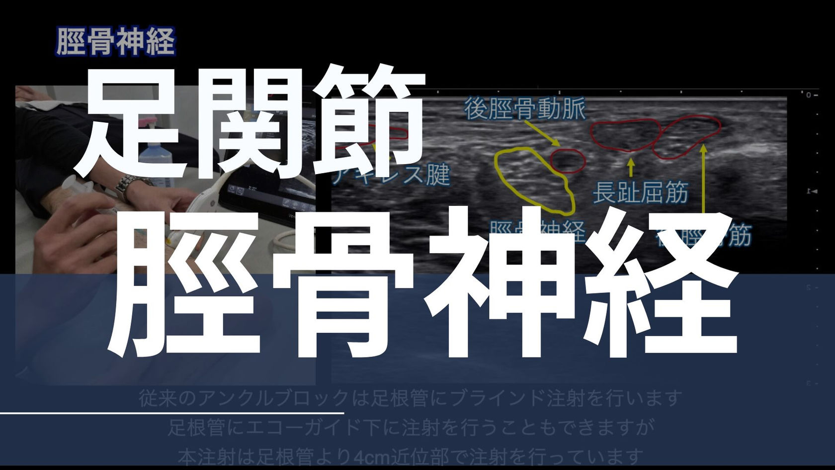 09-008 脛骨神経（下崎研吾2026/1ver.）